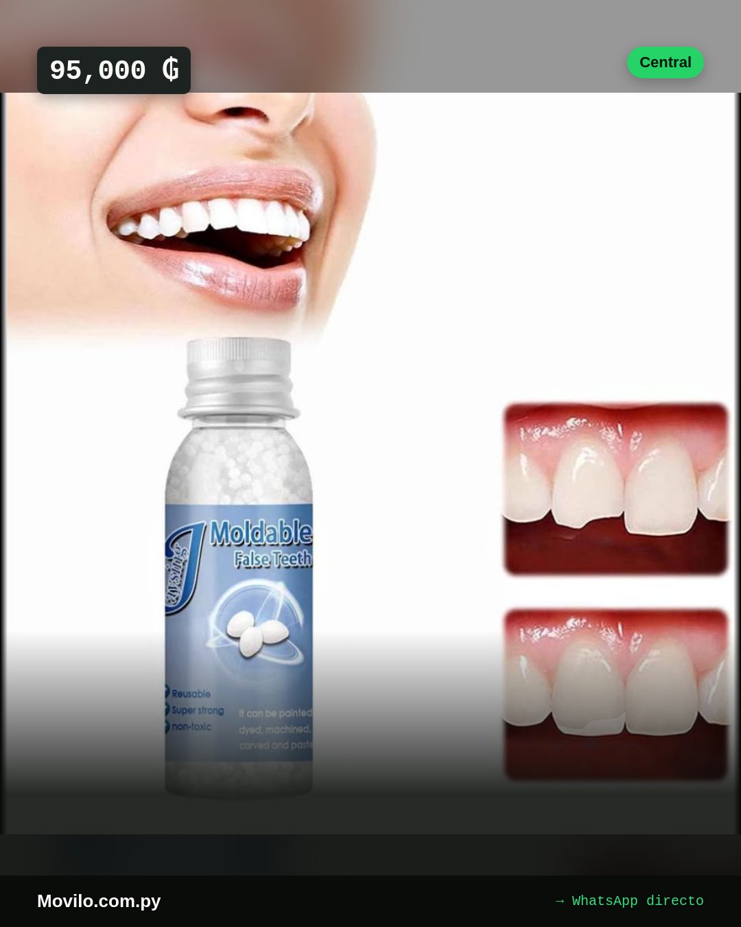 Resina dental